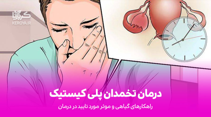 درمان کیست تخمدان با درمان های گیاهی