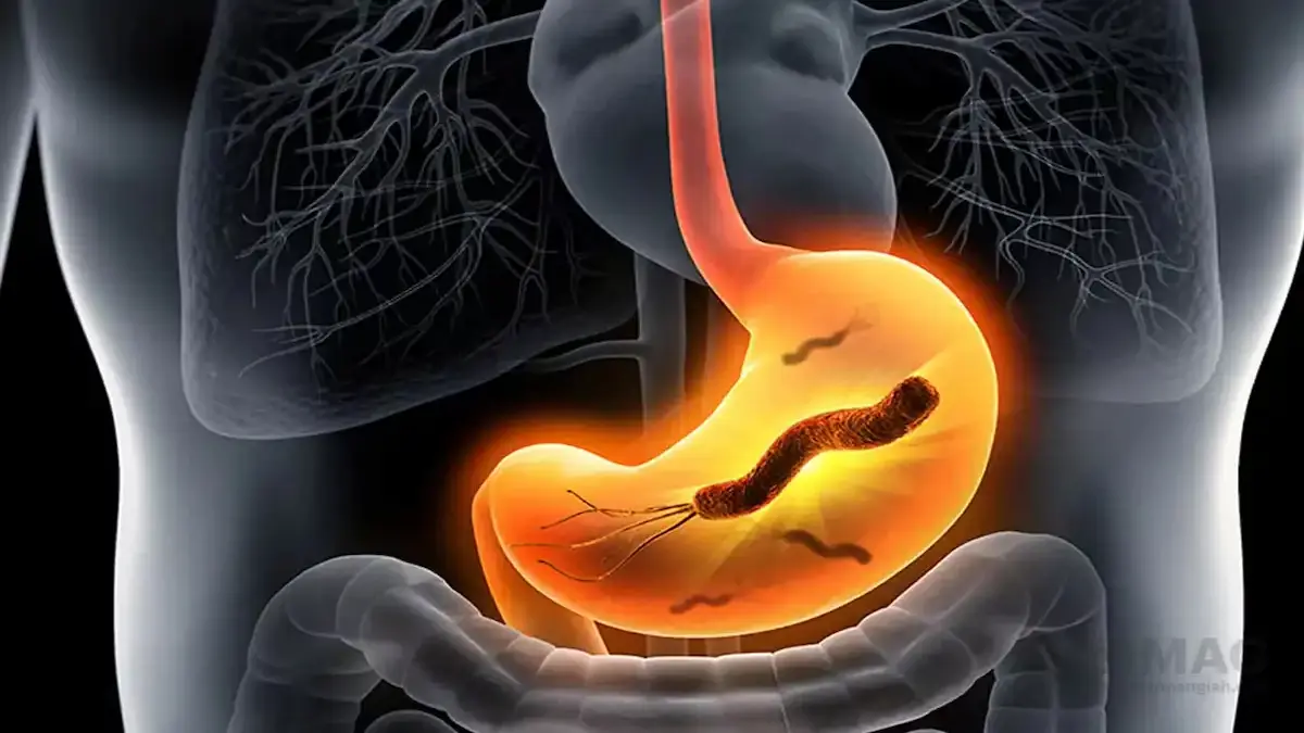 معرفی 11 داروی گیاهی برای کشتن میکروب معده